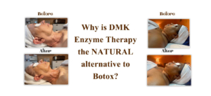 Before and after photos of clients with DMK therapy