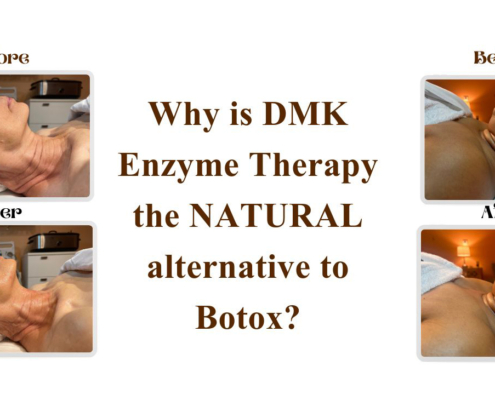 Before and after photos of clients with DMK therapy